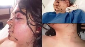 17284357496764774905969592256596